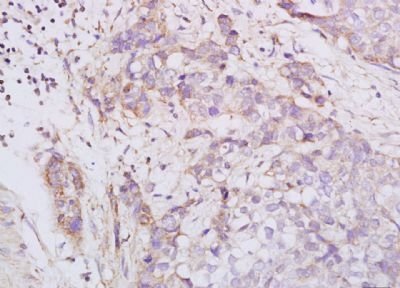 Phospho-PRKAR2A (Ser99) Rabbit Polyclonal Antibody